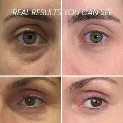 Anti-Ageing Bundle - Get your youth back