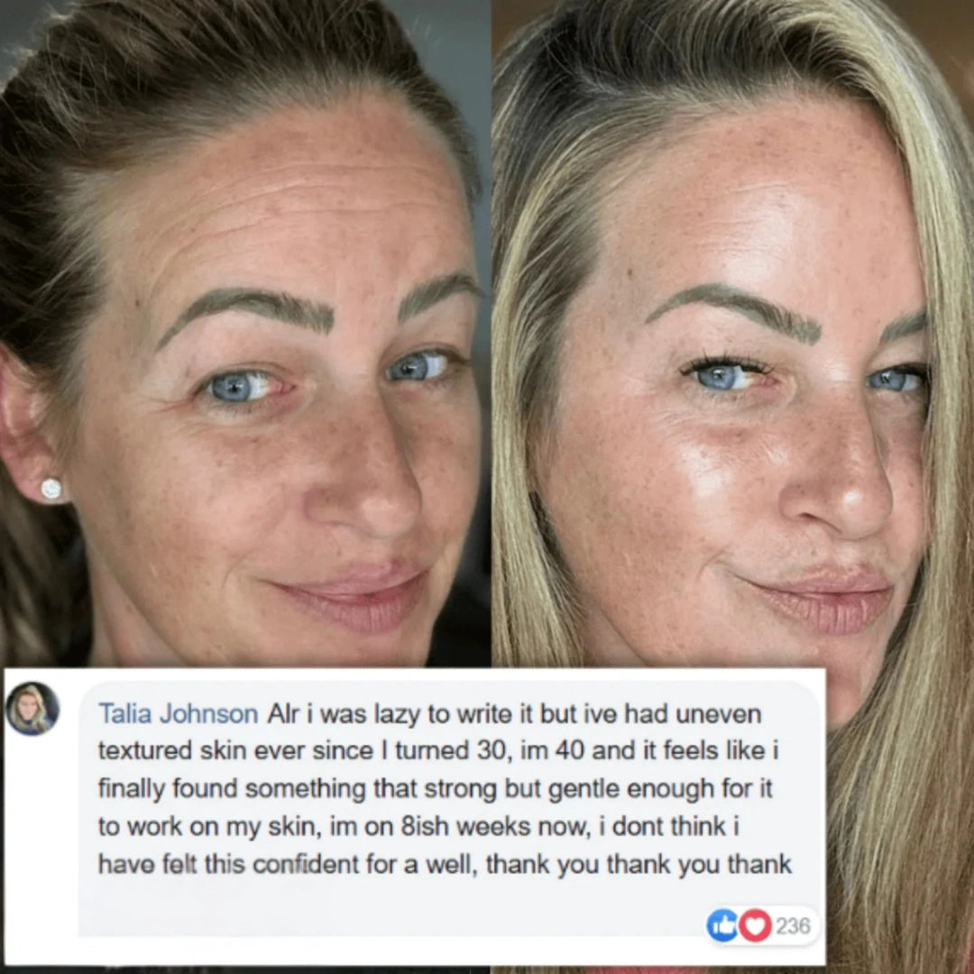 Calcium Balm for Wrinkles, Fine Lines, And Tired Creases Naturally