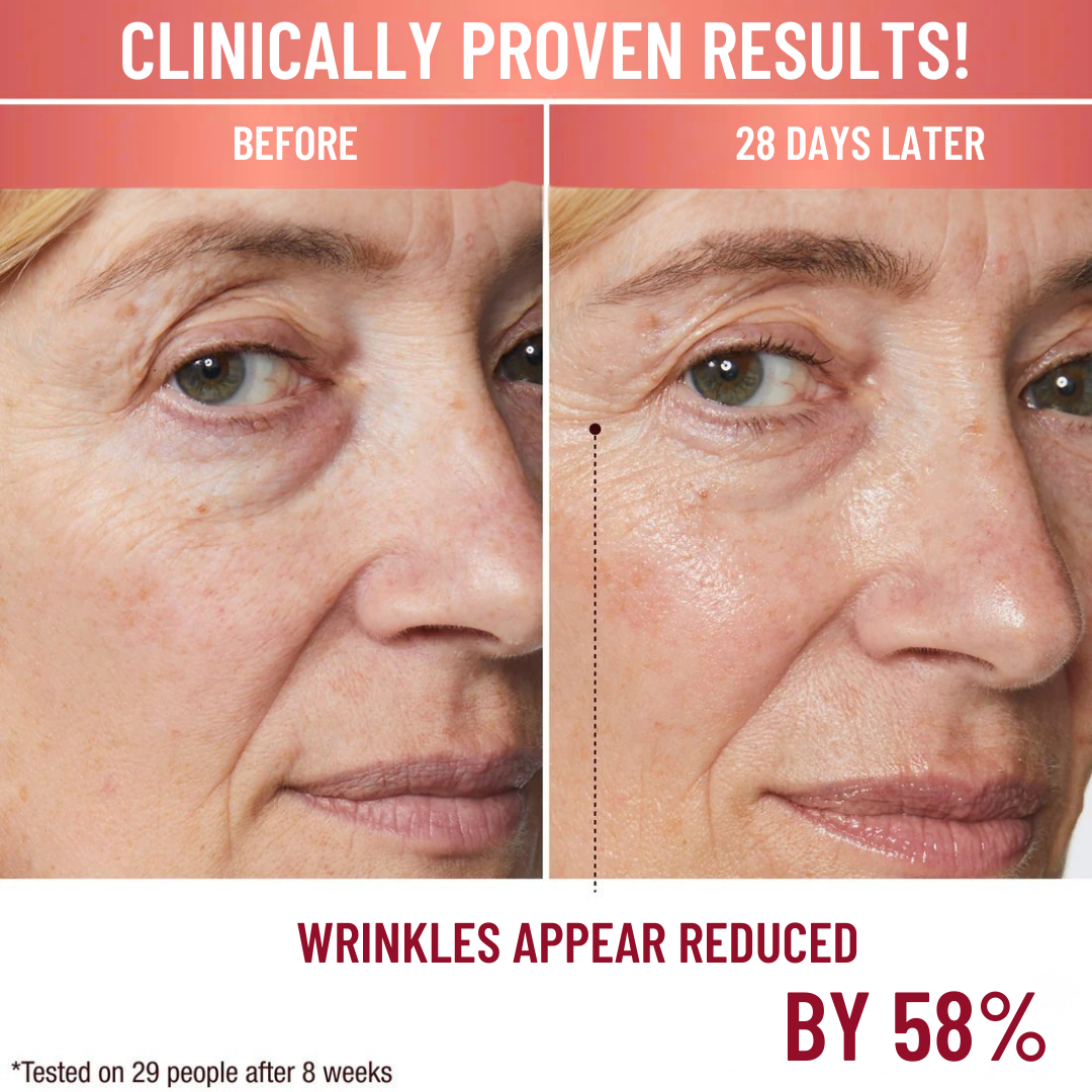 Transform Your Skin From Within Naturally