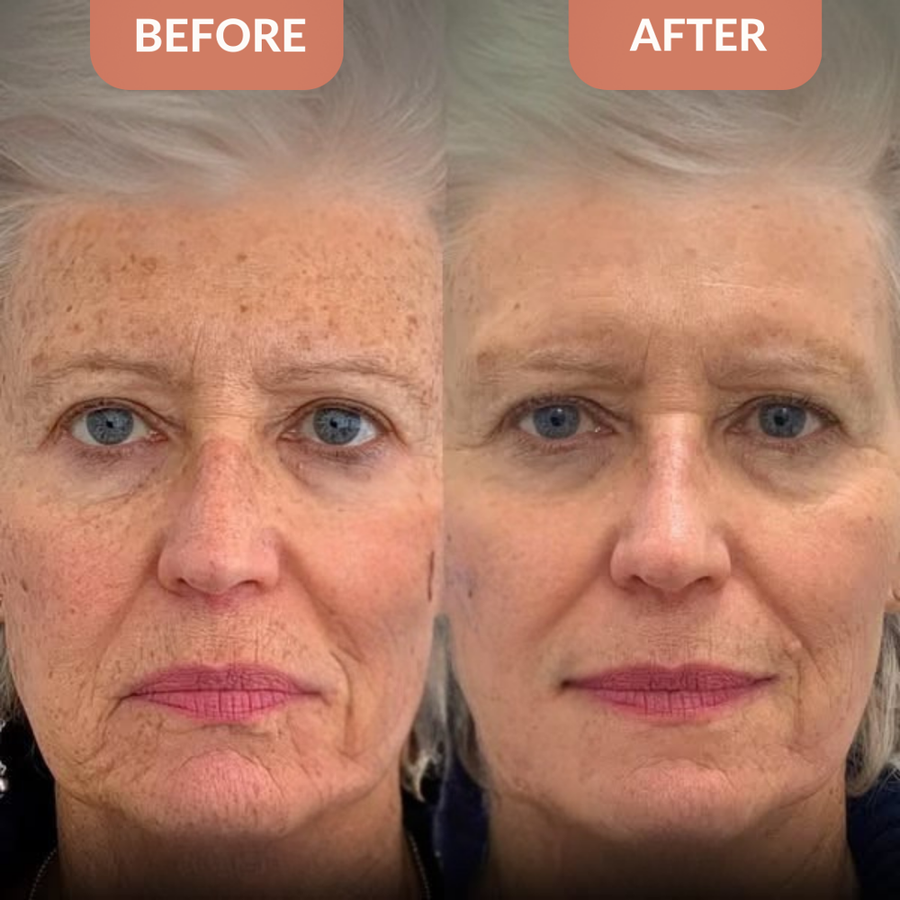 <p><strong>Why Women Are Obsessed</strong></p>