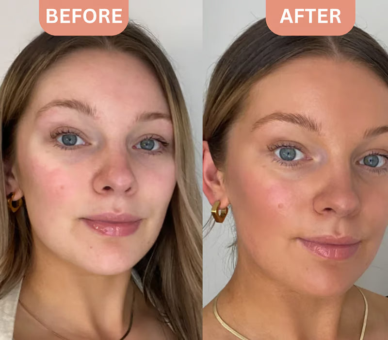 <p><strong>Why Women Are Obsessed</strong></p>